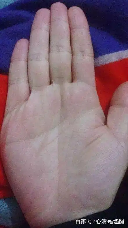 手相金星丘有横纹掌心向内凹陷出现三角纹财运比较旺