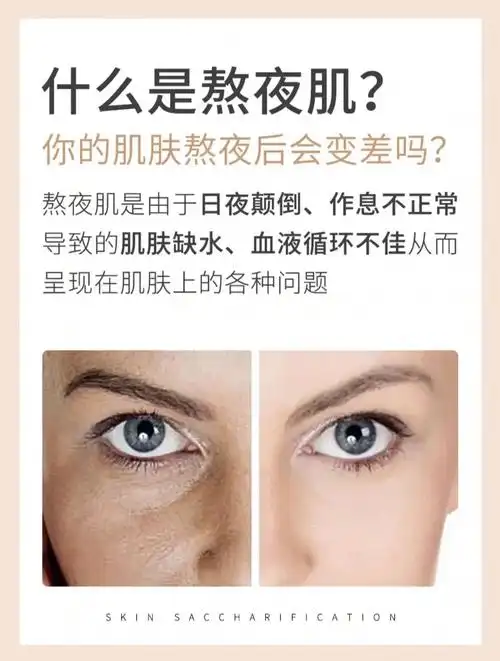 经常熬夜皮肤会怎样