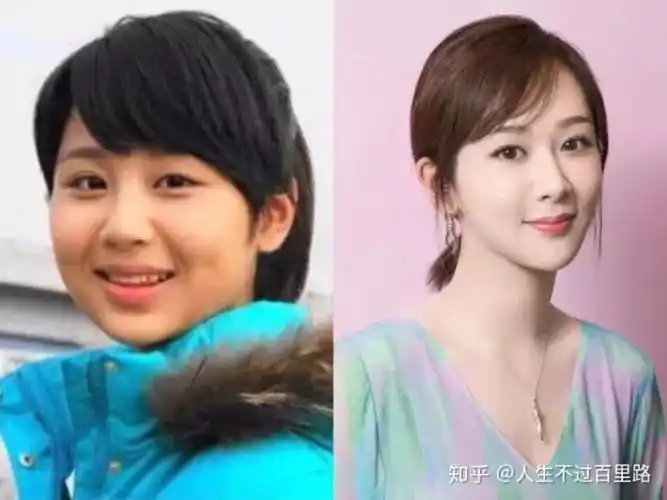 杨紫整容已经不是秘密了