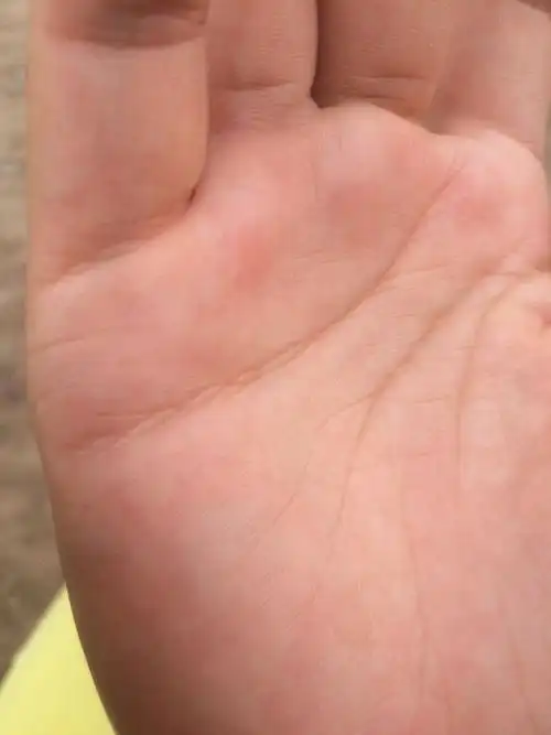 看我的手相,金星丘有三角形是什么预兆?