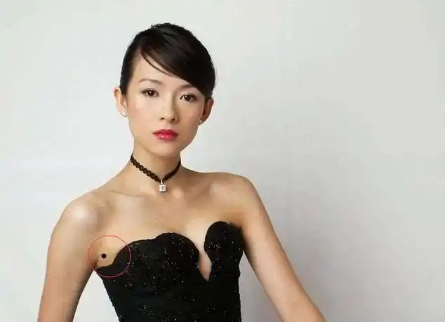 右腋下有痣:贵人运旺盛 痣相上说:右腋下的痣为搂宝,主宝史特多,金玉