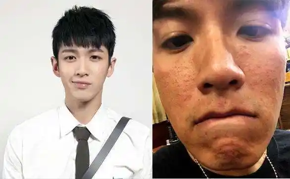 男星素颜照都咋样?胡歌脸上有疤,鹿晗是精修照,王俊凯的我笑了