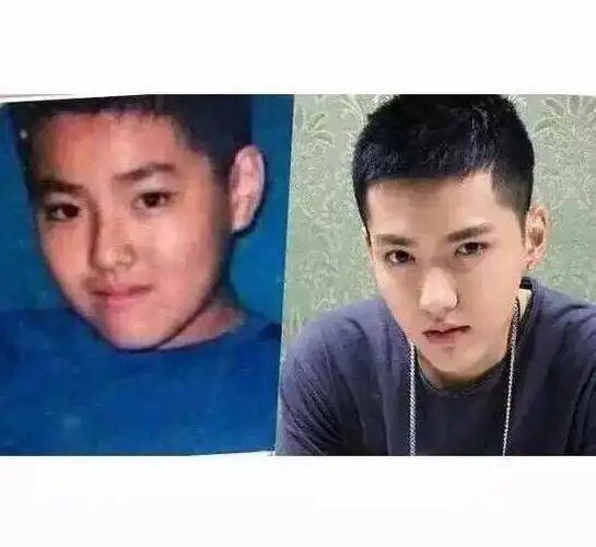 吴亦凡到底整容了没有?