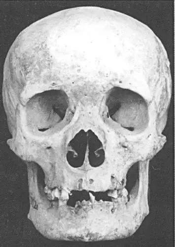 > 辅文-图版二八 沙井三角城人骨,1.hm20 女性头骨 (正,侧面)(图片)