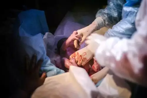 90后产妇要生孩子了,看到医生后,慌忙从产房跑出来了