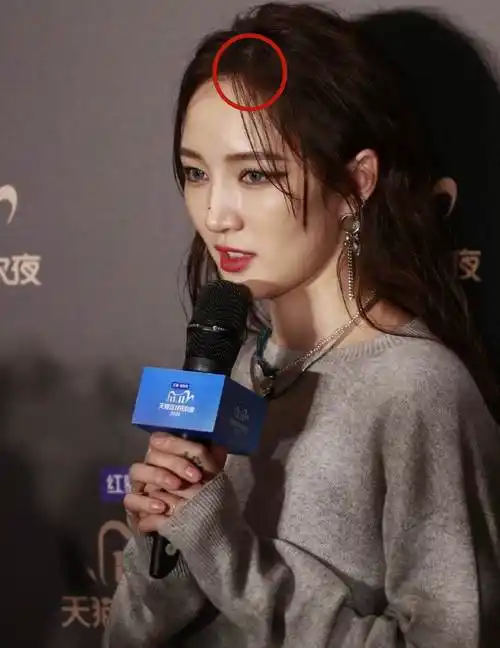 女明星也有秃头危机?有人发际线堪比清朝阿哥,有人走路掉假发片