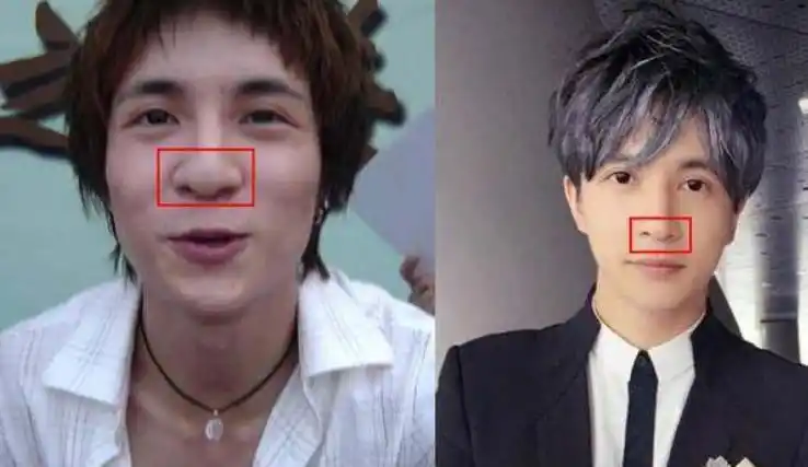 同样是整容,明星是为了变美,袁隆平是为了科学