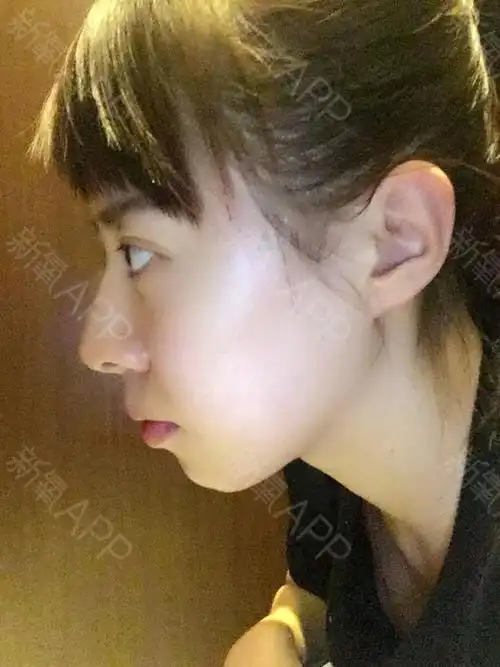 第三张(侧面90度)