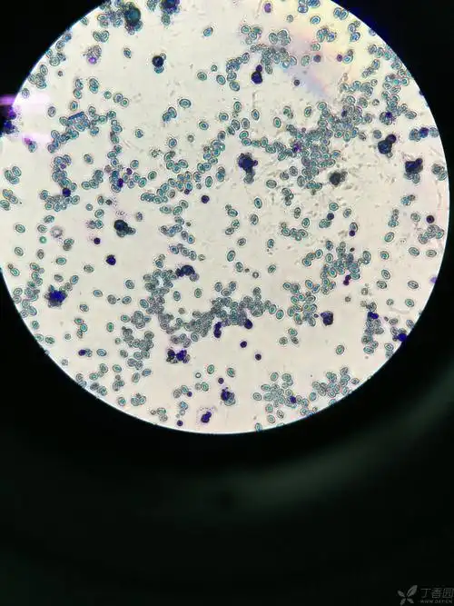 有人做过小鼠腹腔巨噬细胞吞噬鸡红细胞实验么?