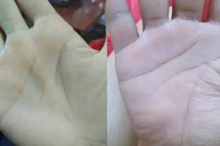 【图】婚姻线断开代表什么 为你分析其中寓意