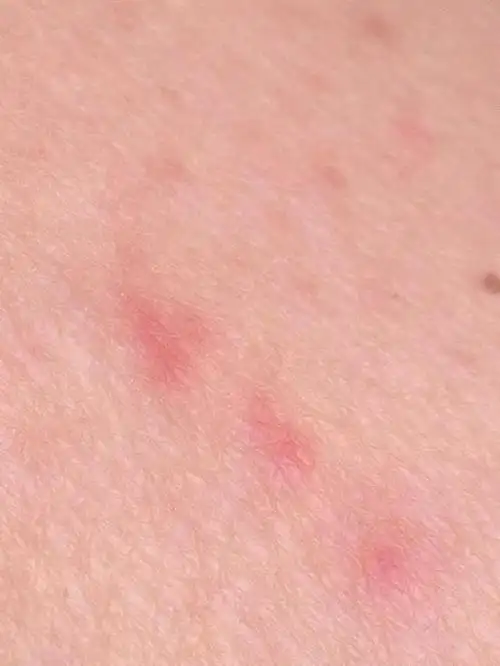 肝不好的人,大部分会有这2特点,若你也有,建议应检查肝脏健康|毒素|内