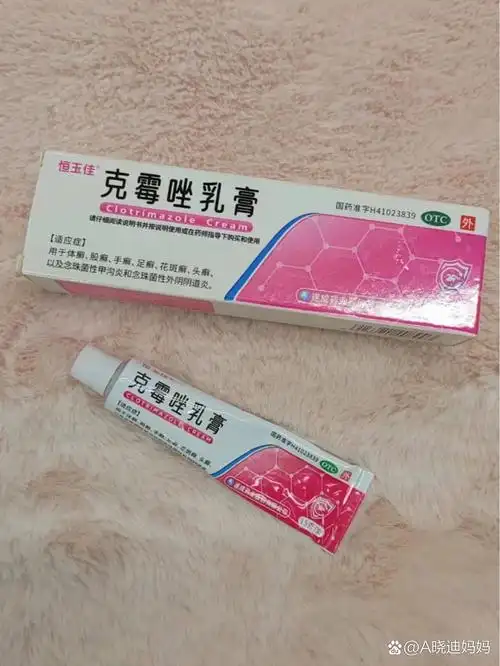 我中招时候用的克霉唑乳膏