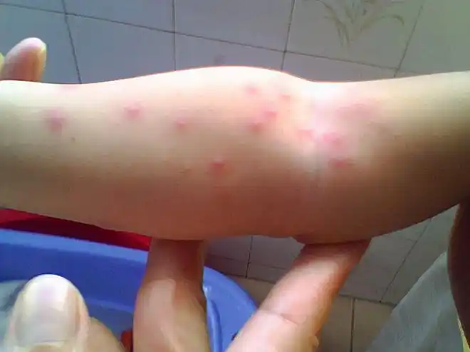 如果孩子对虾不过敏,也不适宜天天吃,在一岁之前,一周吃2~3次即可