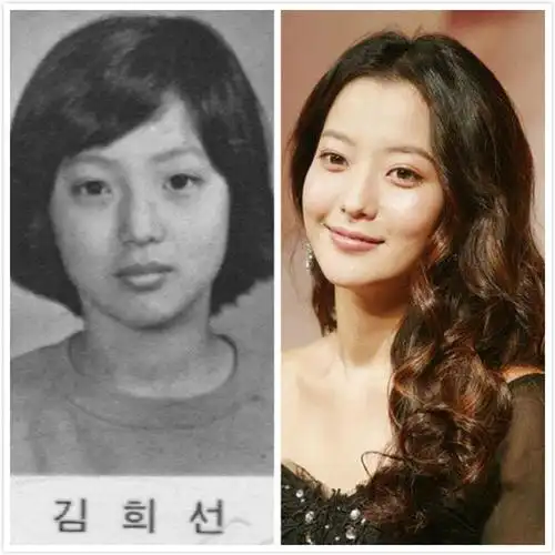 小编看了金喜善的旧照,我实在不理解为什么要跑去整容呢?