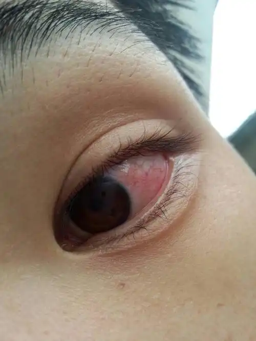 请问我的眼晴怎样才能好啊,要上二十几天夜班,还有十几天煎熬,眼睛老