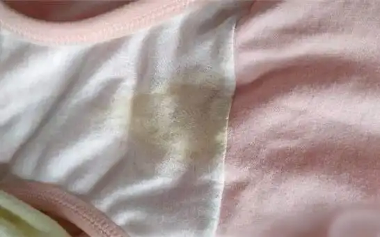 其实,怀孕期间内裤老是湿还伴有黄色污渍在有的孕妇身上比较常见,但是