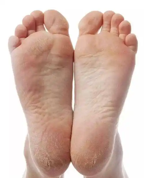 肝脏不好,脚先知,如果脚没出现这4个现象,恭喜你,肝脏挺健康