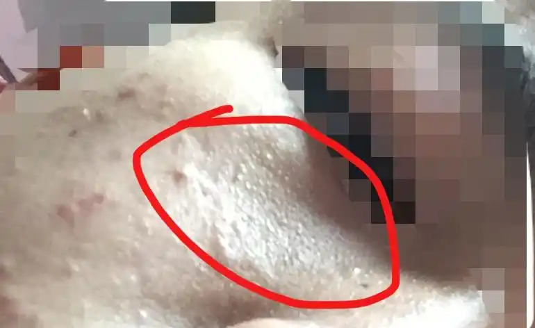 为什么脸上皮肤表层有一粒粒的东西