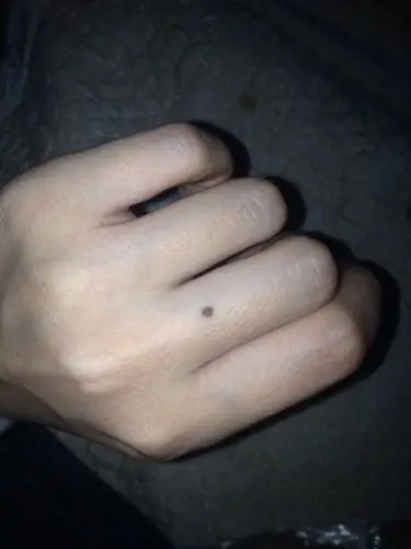 我是左手中指根部.相传是姻缘痣?前生的记忆一直跟到这辈子