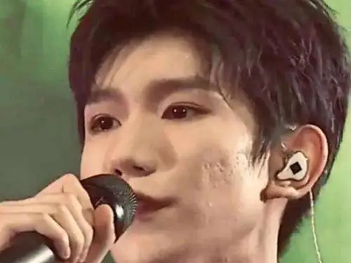 王源抽烟成月球表面抽烟长痘毁所有