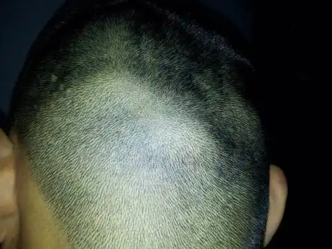 头部有几个肿块这是什么?请老师回答下