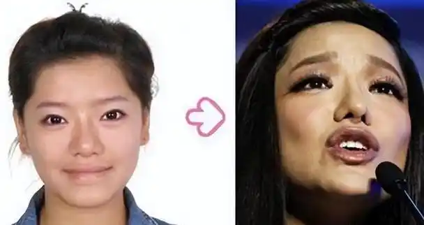 超女冠军江映蓉:整容失败后淡出娱乐圈,现复出依旧无望