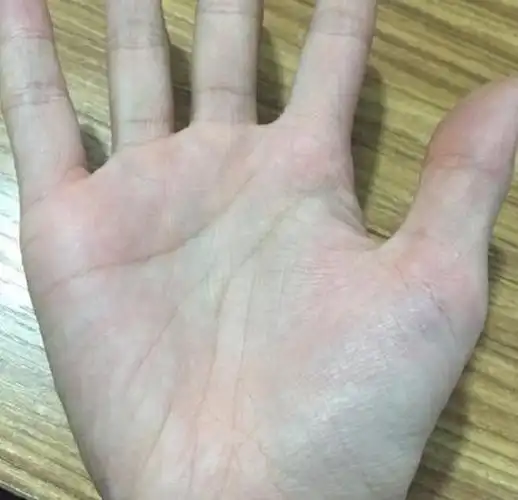 金星丘烦恼多且横过生命线运势不佳且易操劳操心,因外在的原因引起