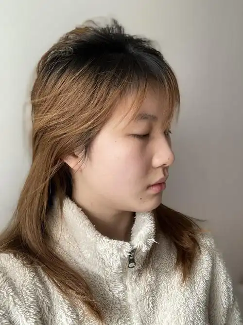 虽然我的鼻梁侧面看也不是很塌,_圈子-新氧美容整形