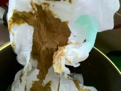 满月混合餵养宝宝五天没有正常大便,吃了妈咪爱后今天大便了,非常酸臭