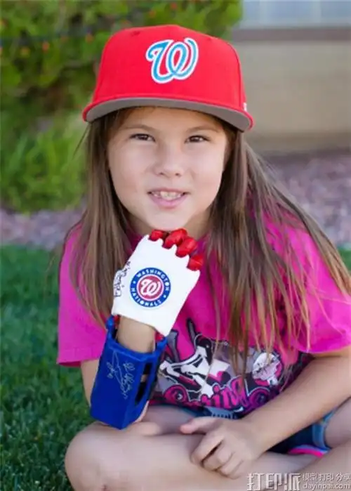 7岁女孩用3d打印假肢为美国职业棒球大联盟世界大赛开球