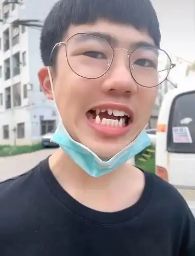 这四颗牙齿就是虎牙,更正规一些的名字就是"犬齿"