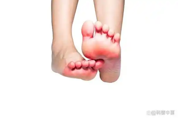 王阿姨走路时觉得前脚掌有点疼,刚开始她没在意,以为是走路累到了,缓