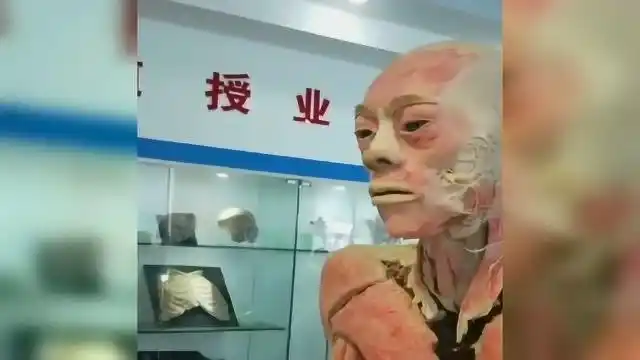 泡了福尔马林的人体标本是这样的,好恐怖啊!_腾讯视频
