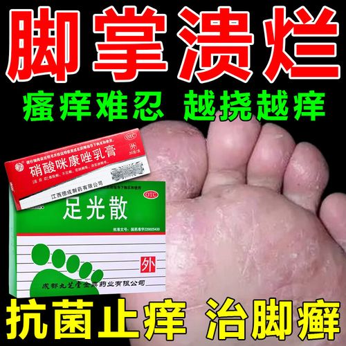 脚气根可搭配治脚趾缝溃烂脱皮痒起水泡 硝酸咪康唑乳膏 1支药膏 一盒