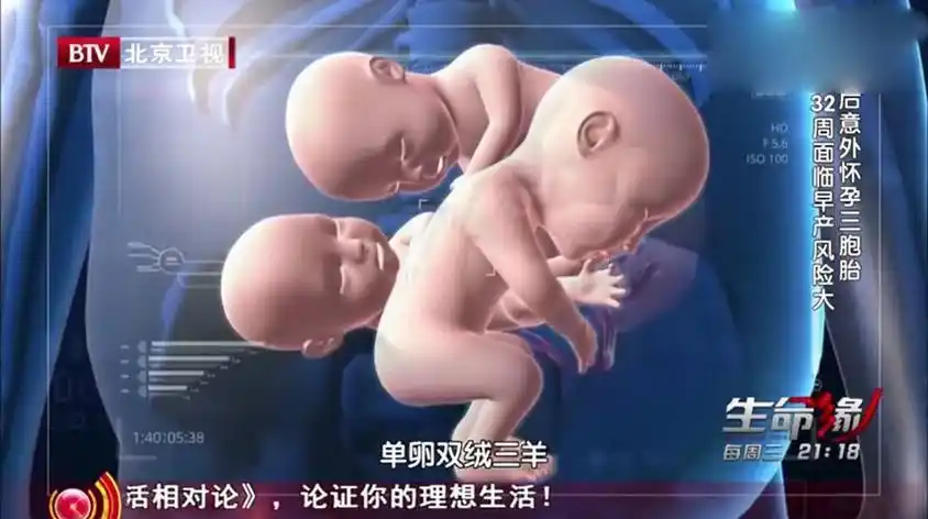 多胞胎孕妇巨肚要生了视频在线观看 - 西瓜视频