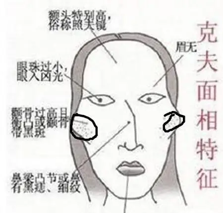 老司机说说颧骨高的女人克夫吗