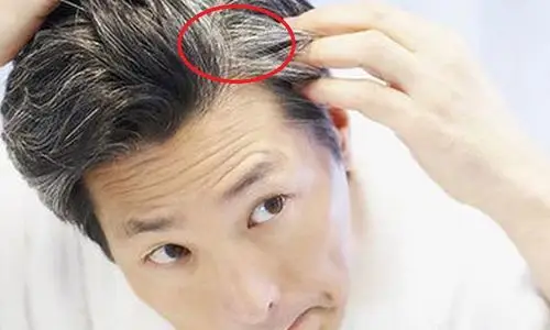 可是人家那是奶奶灰or一袭白发,而不是你那东一撮白发西一撮白发,像被