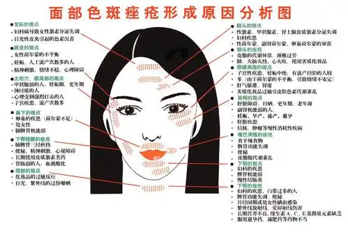 面部黄褐斑让无数女人颜面尽失