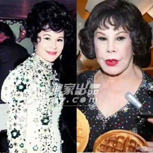 年轻时的黄夏蕙还蛮漂亮的,整容后变得更漂亮,但是现在整容后遗症发作