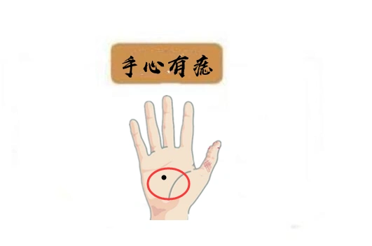 巨富痣,身体4颗黄金痣,个个挣大钱,行大运,万里挑一的好命!