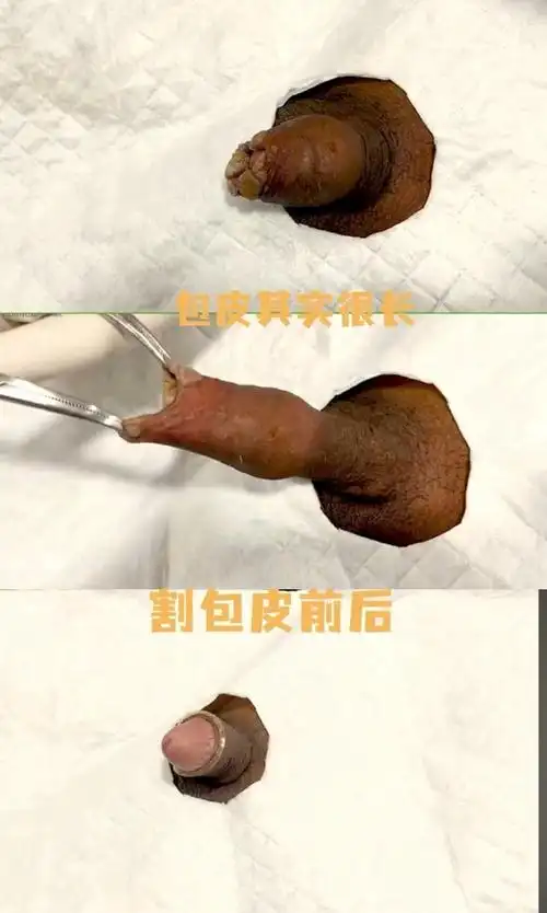 男子上班浏览色情网站被开除辩称电脑中毒