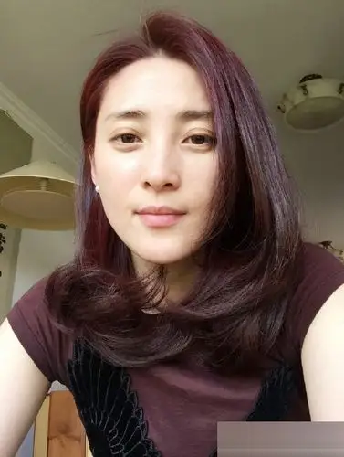 蒋勤勤拍戏受伤 晒淤青称:我也是醉了!(4)