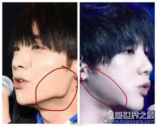 华晨宇整容前后照片对比