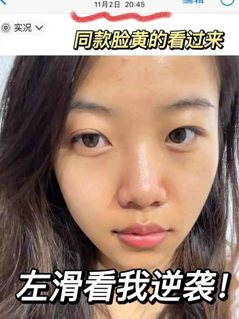 坚持做好这件事,暗沉脸黄真的不见了.#暗沉 #素颜 # - 抖音