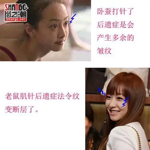 水晶晕倒前看了宋茜是真的吗 2pm为什么避谈宋茜