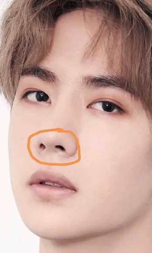 王一博换头术鼻翼疤痕太明显