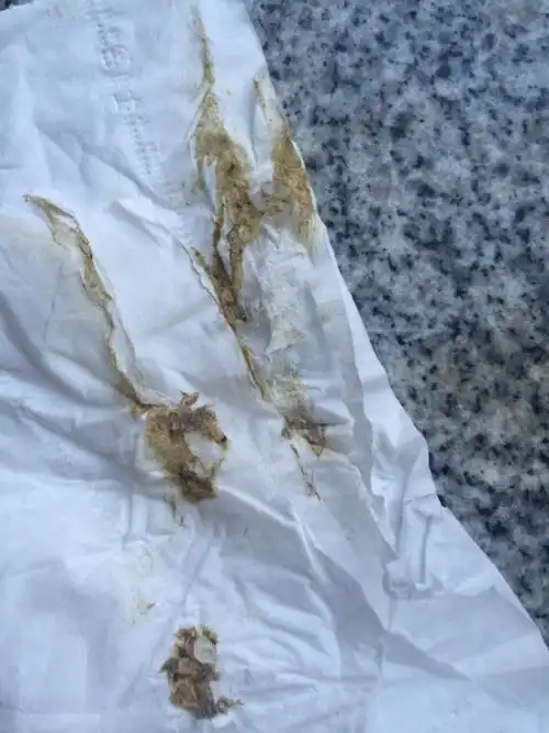 这个颜色算黑便么.