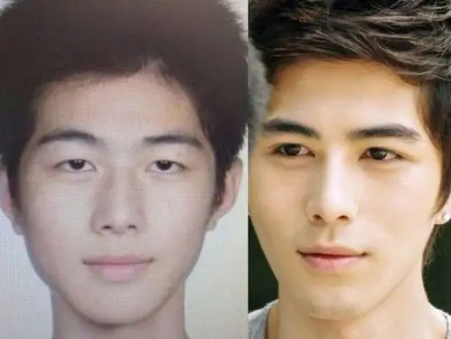 疑陈学冬整容前照片曝光网友双眼皮哪里割的