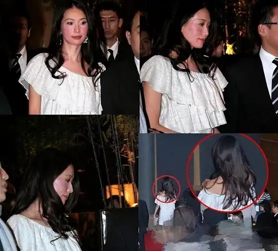 回顾林志玲被家暴流出疑似假体被打出回国修复日本老公出轨