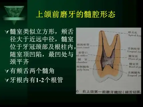 口腔解剖生理学上颌前磨牙的髓腔形态